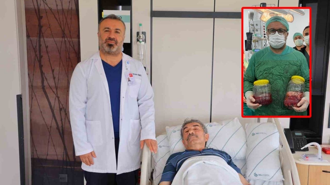HG Hoaspital'da 20 cm böbrek tümörü alındı